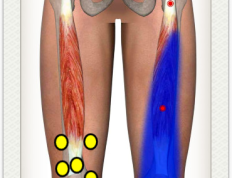 膝盖疼滑膜炎问题处理解说