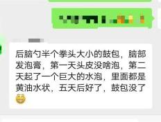 头道排毒膏消肉包案例