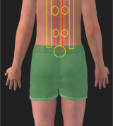 高血压的拔罐参考思路