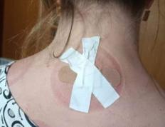 富贵包两个案例参考