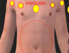 颈椎病富贵包头晕头疼等取穴