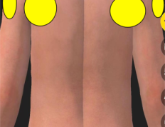 肩膀肩周炎问题的取穴方法