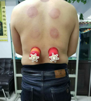 萨满48穴取穴点。萨满罐取穴方法参考。