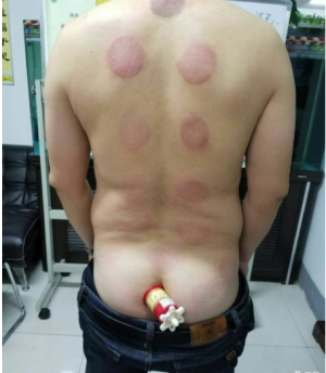 萨满48穴取穴点。萨满罐取穴方法参考。