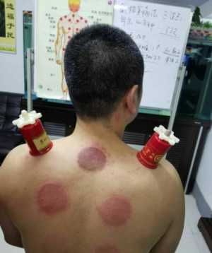 萨满48穴取穴点。萨满罐取穴方法参考。