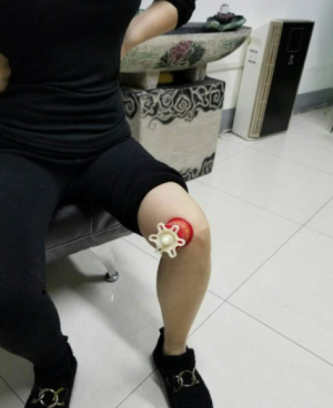 萨满48穴取穴点。萨满罐取穴方法参考。